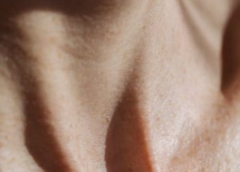 Sensitive Skin Solutions: Gentle Care for Delicate Complexions